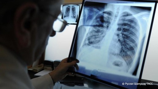 Медики из Красноярского края первыми в России начали системно использовать ИИ для диагностики туберкулеза, сообщили в Минздраве региона