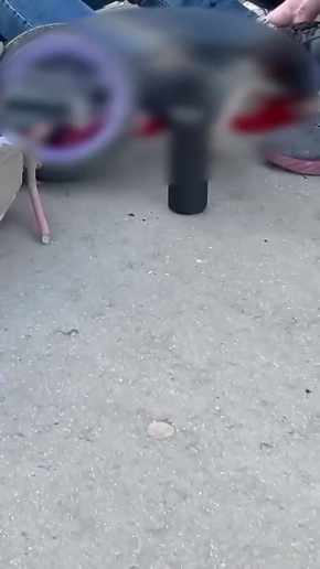 В Москве две девочки на электросамокате сбили пенсионера