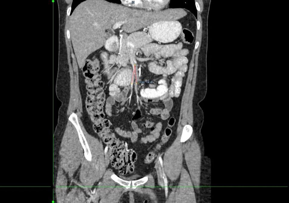 ��� ����� ��������� ���������: ������� �������������� ���������� � ������ ������������