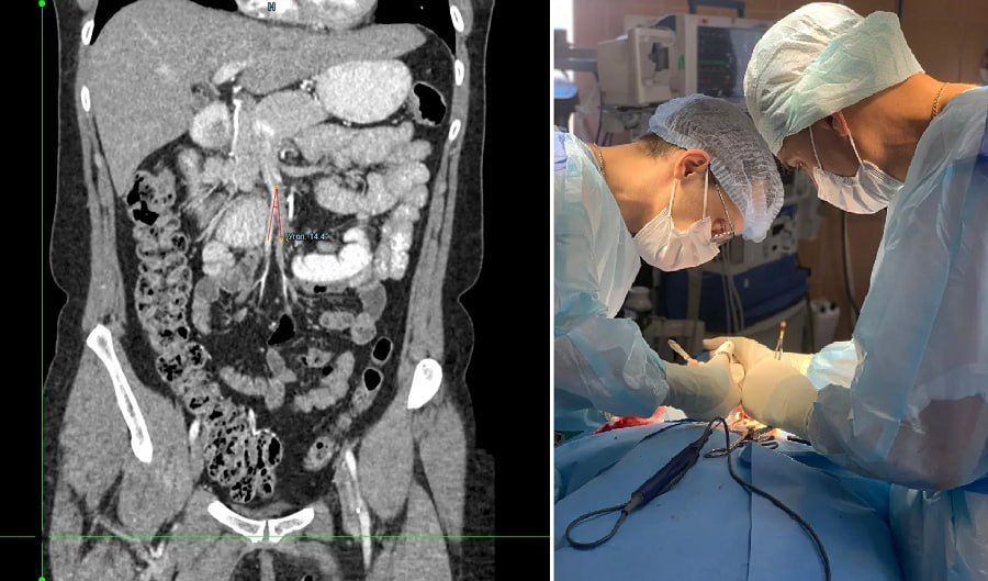 #* �������� ���������� �������� �� �������� � ����� ����