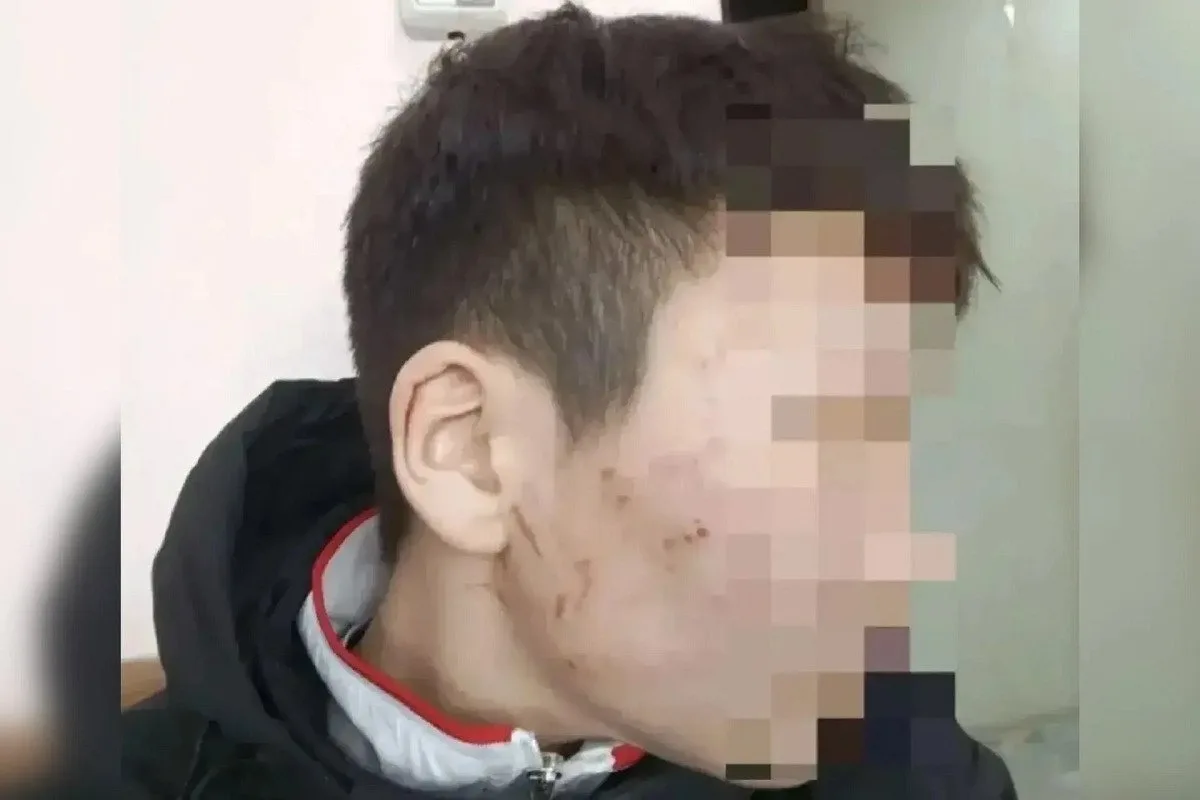 «Я лучше буду жить в интернате, чем с мамой»: жительница Тувы избила сына после его отказа от поездки к шаману