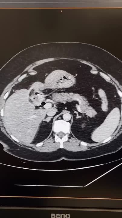 ������������ ����� ������ ��������� � ����������� �������������� �������