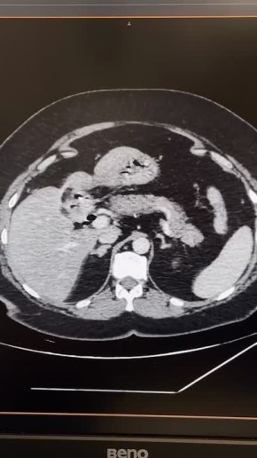 ������������ ����� ������ ��������� � ����������� �������������� �������