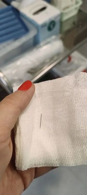 Красноярские врачи помогли пациентке со швейной иглой в ноге Красноярские врачи помогли пациентке со швейной иглой в ноге