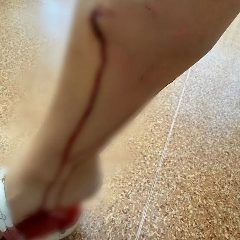 В Большемуртинском районе шесть домашних собак напали на мать двоих детей